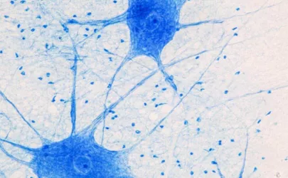 Abbildung von Nervenzellen des Gehirns