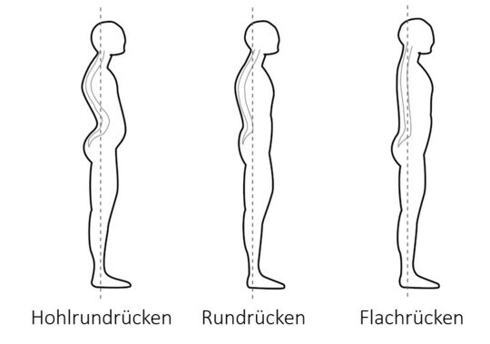 Iluustration von Rückenformen